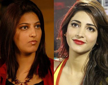 Shruti Haasan Before and After Nose surgery